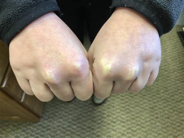 Can you make your knuckles bleed?