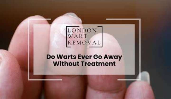 Do warts go away without treatment?