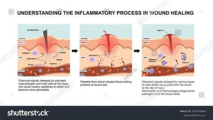 How does inflammation hinder healing?