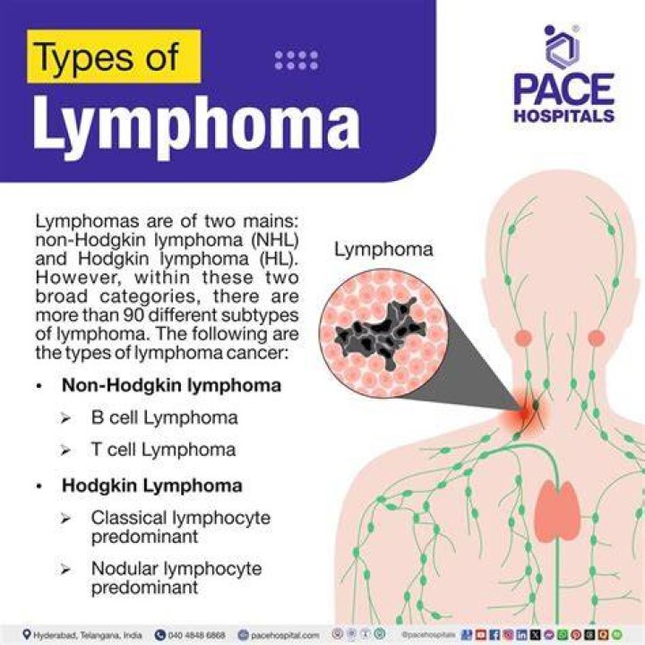 Is it hard to diagnose lymphoma?