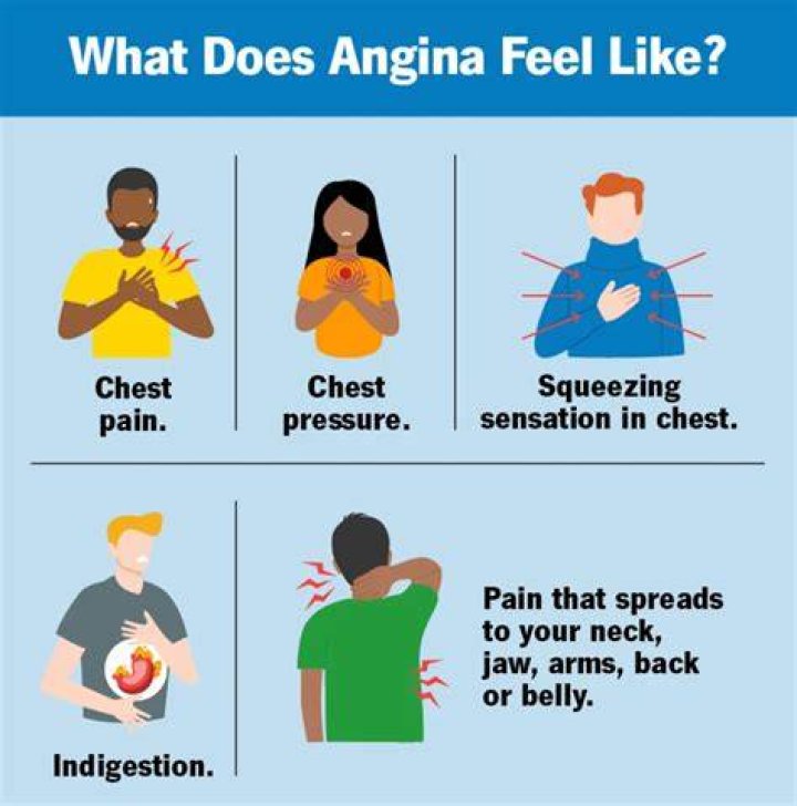 What does angina feel like for a woman?