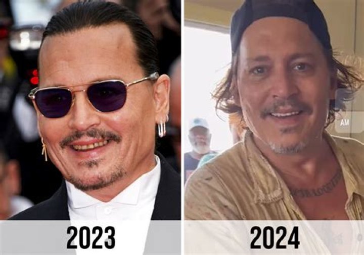 What does Johnny Depp have on his teeth?