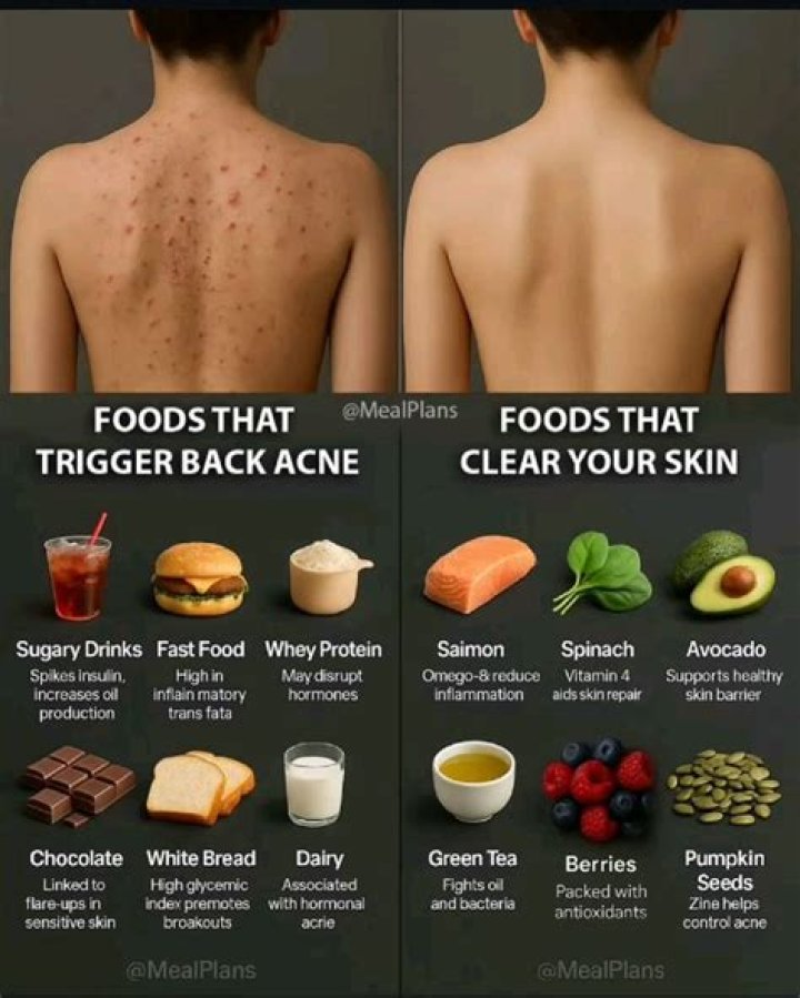 What foods cause blind pimples?