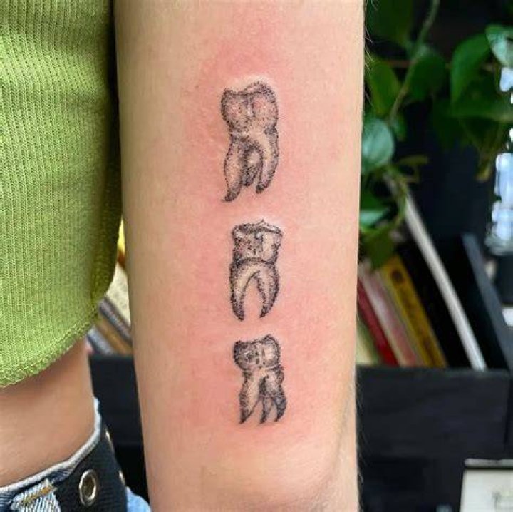 What is a tooth tattoo?