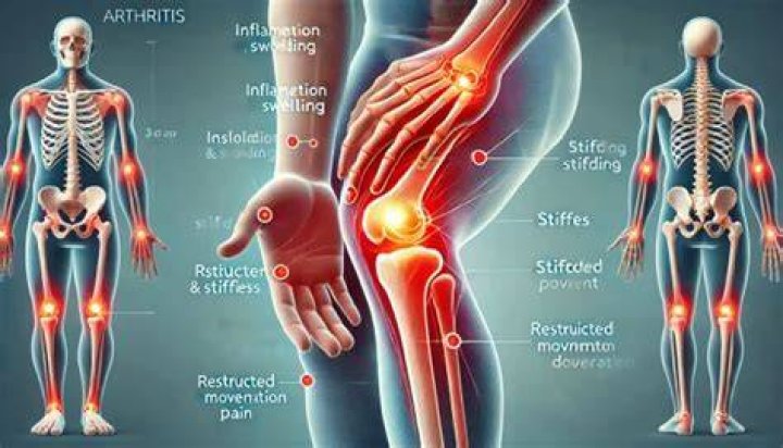 Why do people get arthritis?